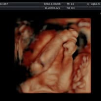 Fetal therapeutic procedure